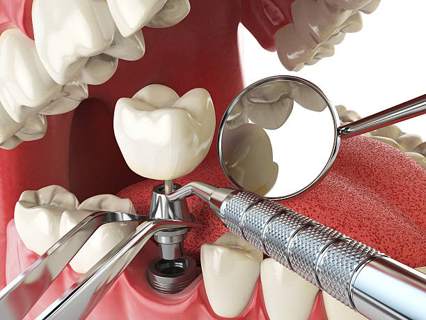 Best Same-Day Emergency Dental Services in Terra Alta, WV